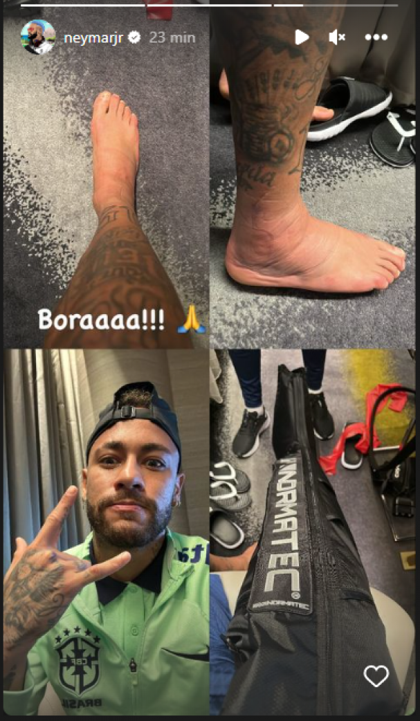 Tobillo de Neymar