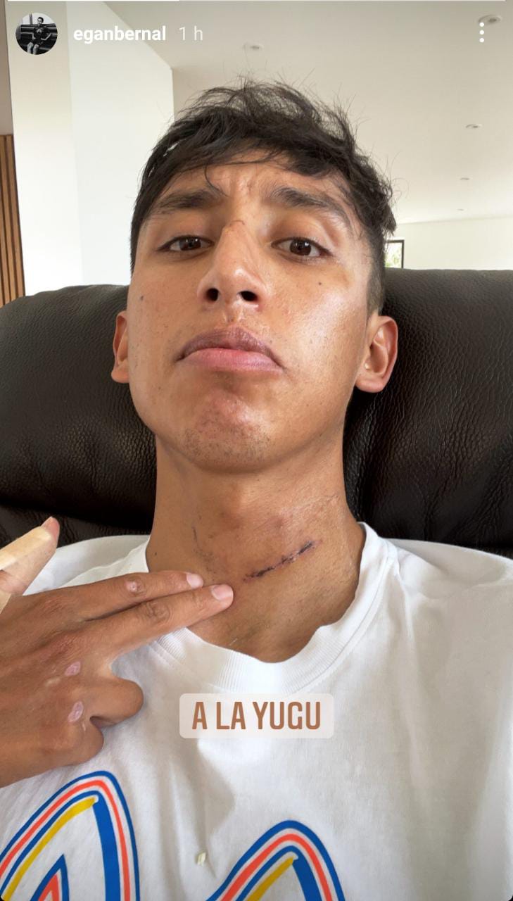 Cicatriz de Egan Bernal