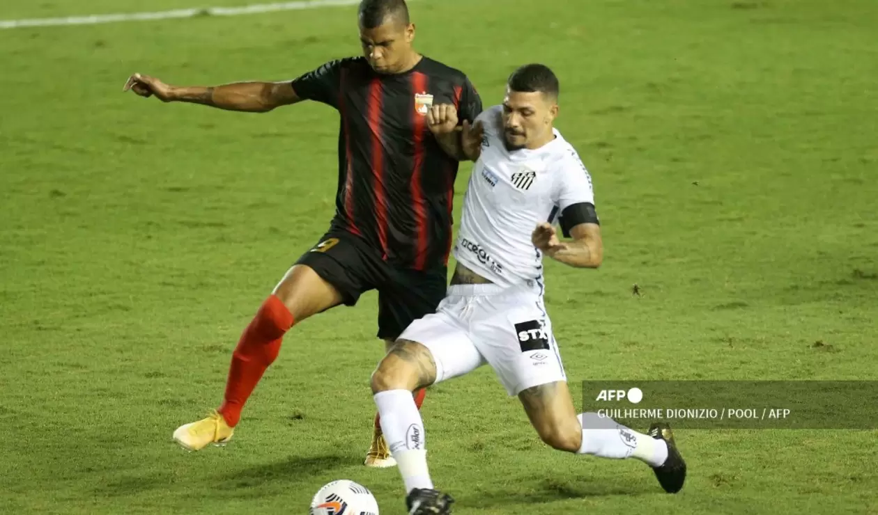 Santos vs Deportivo Lara 2021