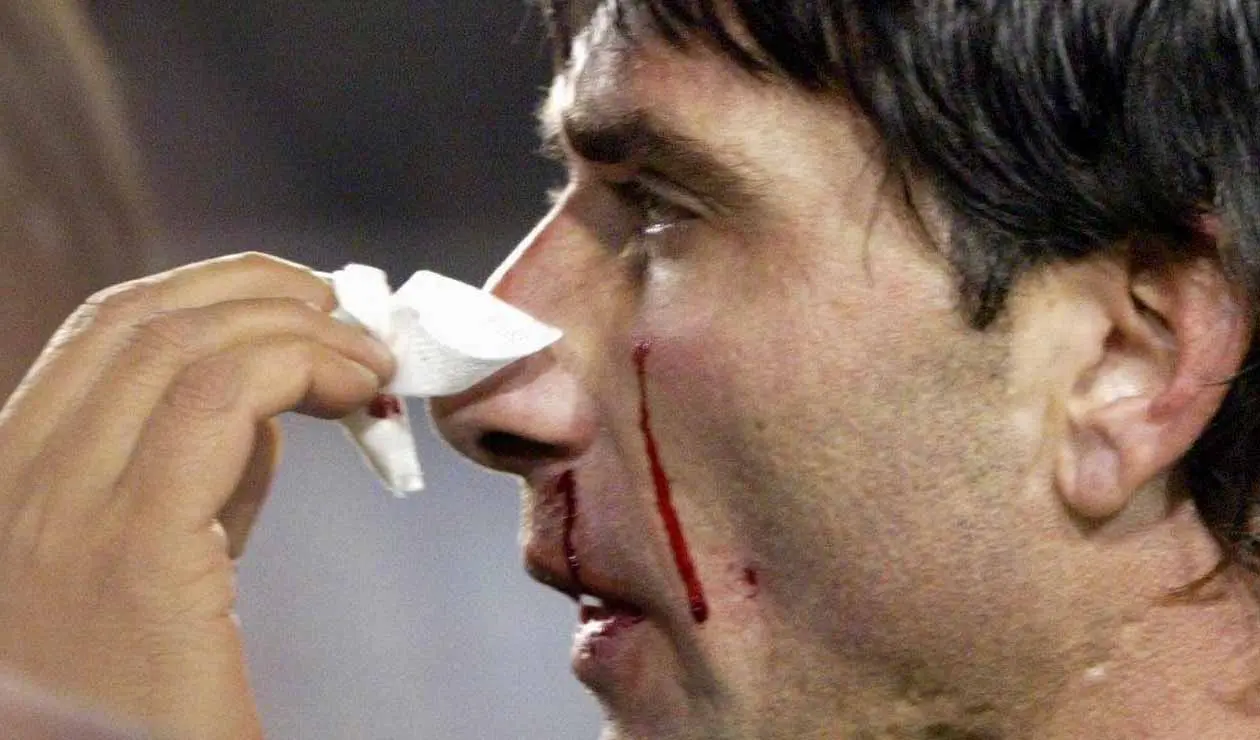 Roberto Abbondanzieri sufrió un golpe de Marcelo Gallardo -semifinal Libertadores 2004