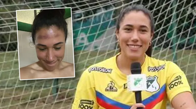 vanessa Córdoba, golpe en la cara
